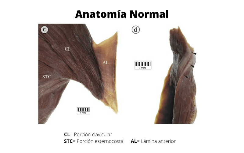 Anatomia Normal B.png